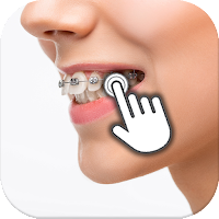 Braces on teeth: Photo editor MOD APK v1.3 (Unlocked)